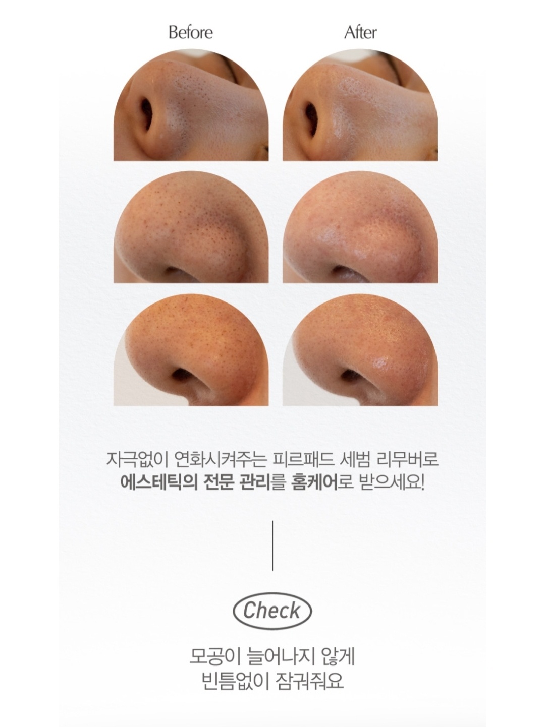 코피지제거 코팩 피르패드 50매 1박스